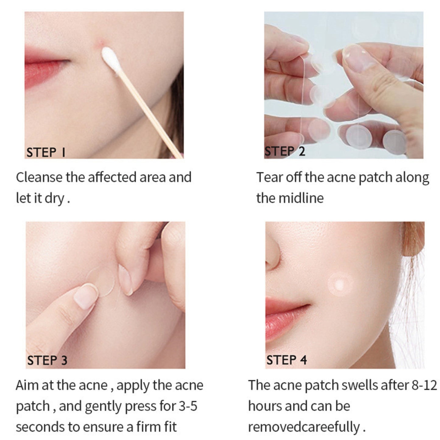 Anti-Acne Concealer Patch - Invisible Blemish Protection (72 Patches)