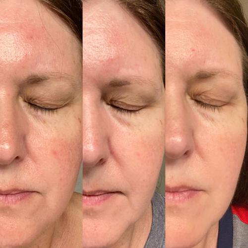 LED Therapy Face Mask | 7 Color Light Modes | Home Skin Care Device