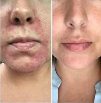 LED Therapy Face Mask | 7 Color Light Modes | Home Skin Care Device