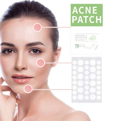 Anti-Acne Concealer Patch - Invisible Blemish Protection (72 Patches)