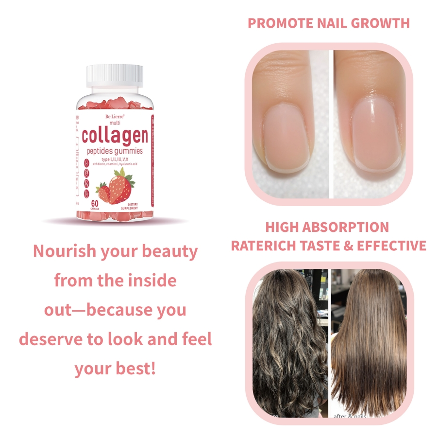 Collagen Peptide Gummies - Skin, Joint, and Hair Support in Every Chew