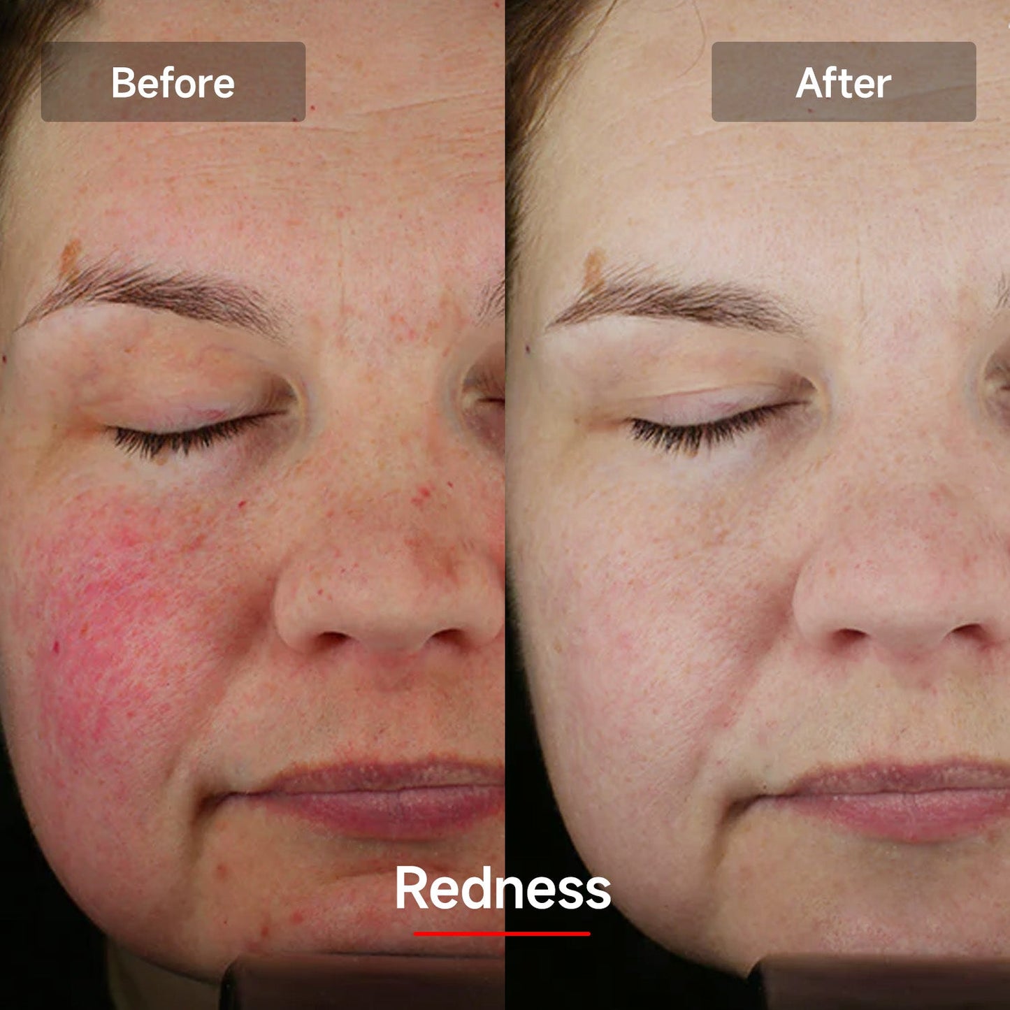 LED Red Light Nano Face Mask 2.0 | Light Therapy Facial Beauty Device | Home Use