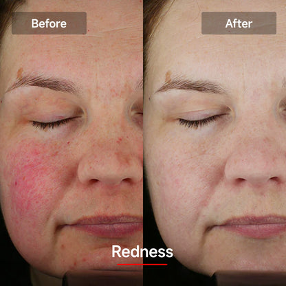 LED Red Light Nano Face Mask 2.0 | Light Therapy Facial Beauty Device | Home Use